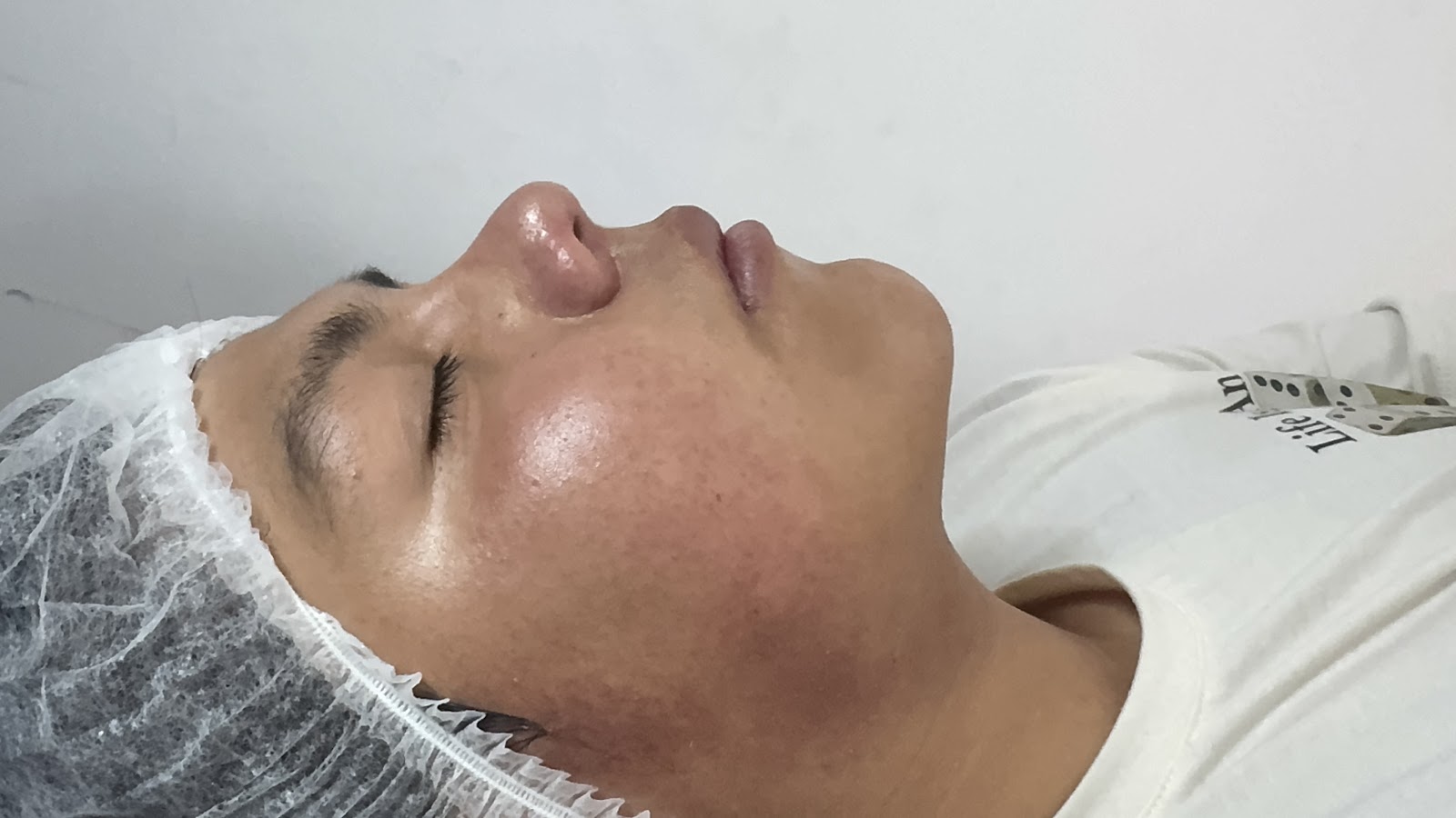 Primer plano de un tratamiento facial en Aquanova Spa